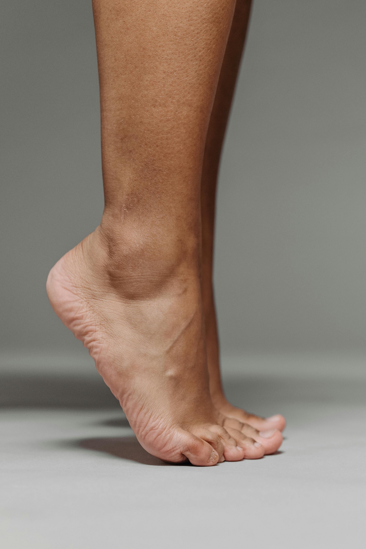 Achilles tendinopathy: why your heel pain isn't going away and what to do about it